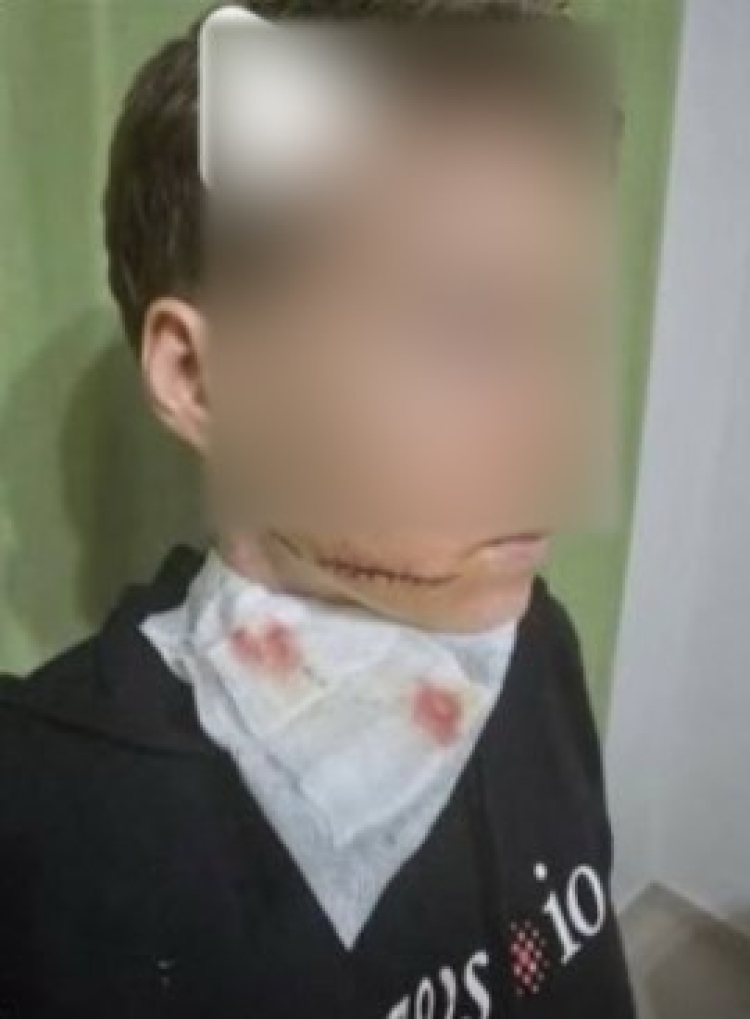 Alanya'da yolda yürüyen bir kadına yumruk atıp, makasla yüzünü yaralayan şahıs tutuklandı 3