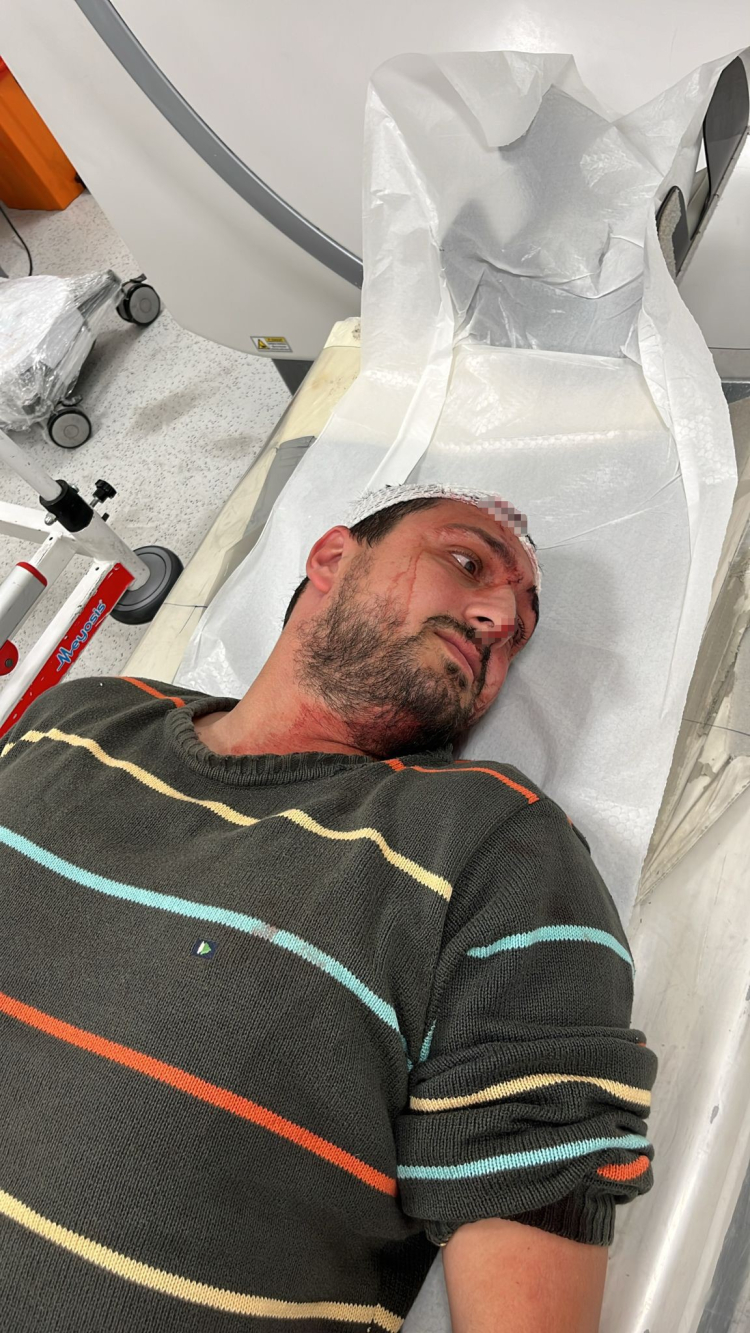 Otizmli gence odunluğa baktı diye odunla saldırı iddiası 2