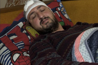 Otizmli genç, fırın çalışanı tarafından darp edildi