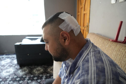 Amcası tarafından boğazından ve kafasında bıçaklanan motokurye: "Kendisi serbest, can güvenliğim yok"