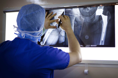 Geri dönüşü olmayan eklem hasarına protez çözümü