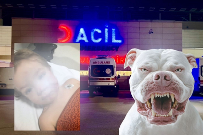 Ankara Etimesgut’ta pitbull dehşeti: 1 buçuk ve 5 yaşındaki iki kardeş saldırıya uğradı, aile ve mahalleli isyan etti