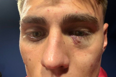 Kazımcan Karataş’a çakmak atan taraftara gözaltı ve 1 yıl men cezası