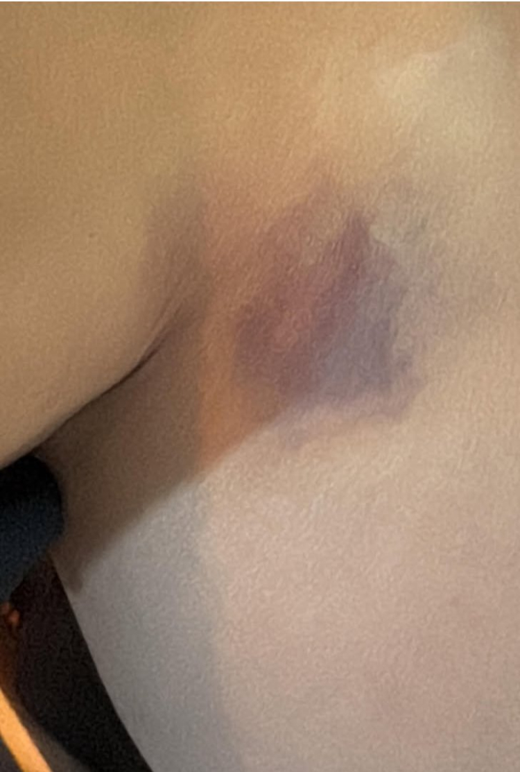 yıldız asyalı darp