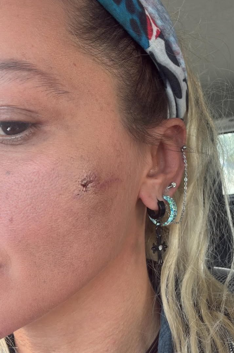 yıldıx asyalı darp