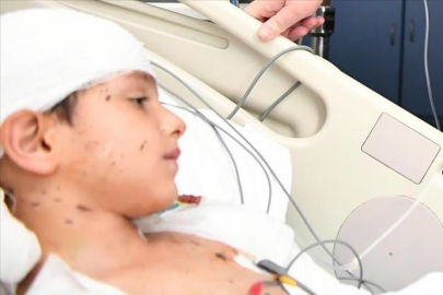 Ankara'da sahipsiz köpeklerin saldırdığı Tunahan Yılmaz'ın ailesine 5 milyon lira manevi tazminat kararı