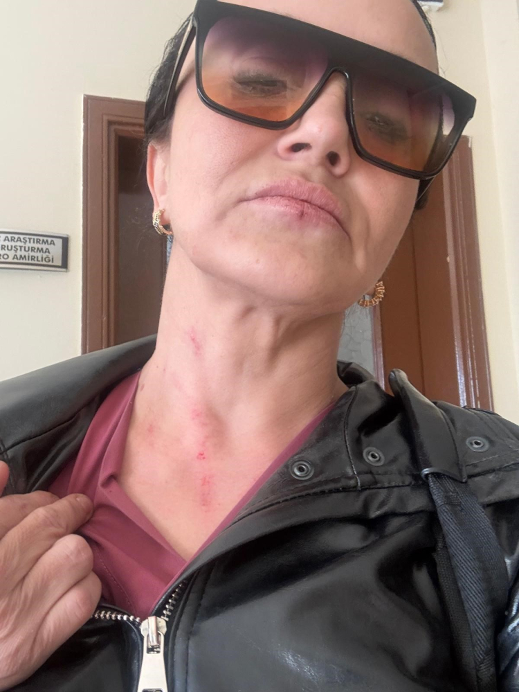 Adana’da boşanma sürecindeki kadının evine çilingirle girildi 3