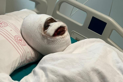 Eski eşi tarafından vahşete uğrayan kadın o anları anlattı, acılı baba sert tepki gösterdi