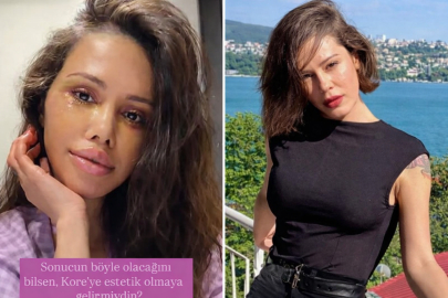 Eski Survivor yarışmacısı Didem Ceran Kore'de 'yüz nakli' olduğunu açıkladı