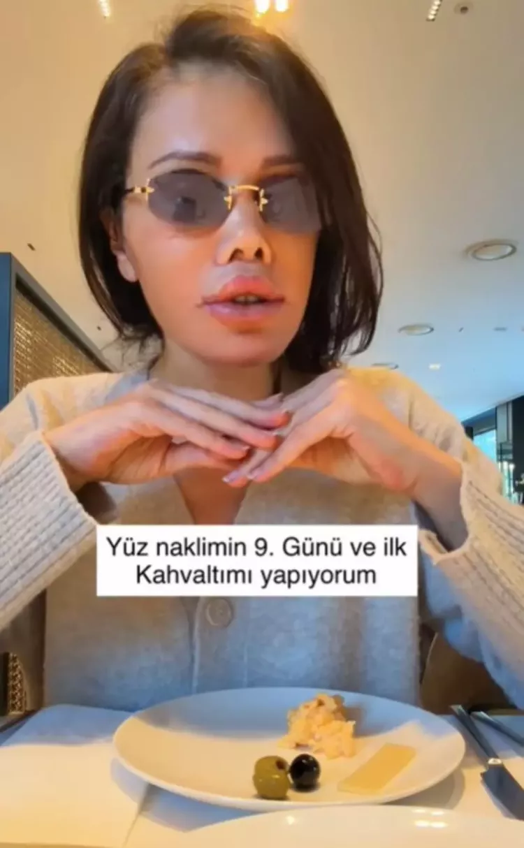 Eski Survivor yarışmacısı Didem Ceran Kore'de 'yüz nakli' olduğunu açıkladı 2