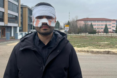 Eskişehir’de okulda çaylı saldırı iddiası!