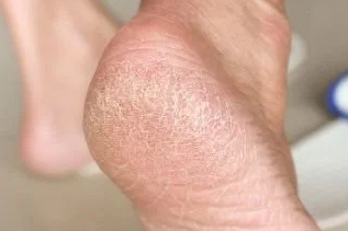 NASIRI KÖKÜNDEN TEMİZLEYEN İKİLİ!