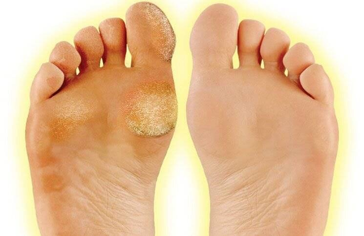 Dikkat Edilmesi Gerekenler