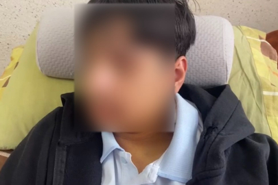 Okulda dehşet anları: 9. sınıf öğrencisinin çenesi kırıldı