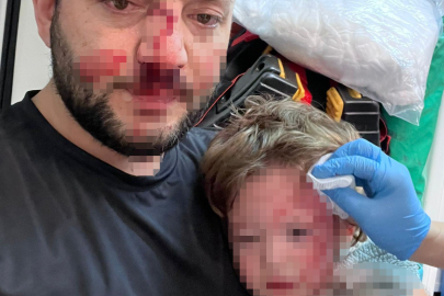 Yalova'da komşuların gürültü kavgasında 14 aylık bebek hastanelik oldu