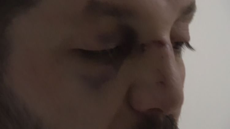 Yalova'da komşuların gürültü kavgasında 14 aylık bebek hastanelik oldu 3