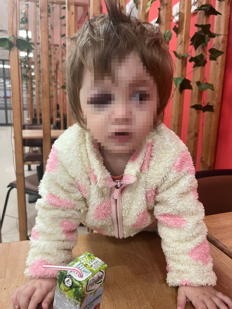 Yalova'da komşuların gürültü kavgasında 14 aylık bebek hastanelik oldu 4