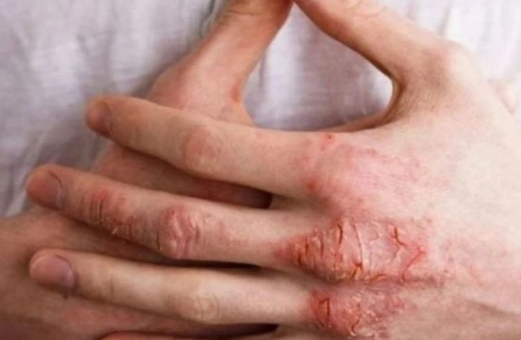 Duş öncesi kritik adım