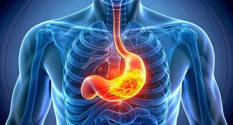 Ağıza acı su gelmesi ve ekşime