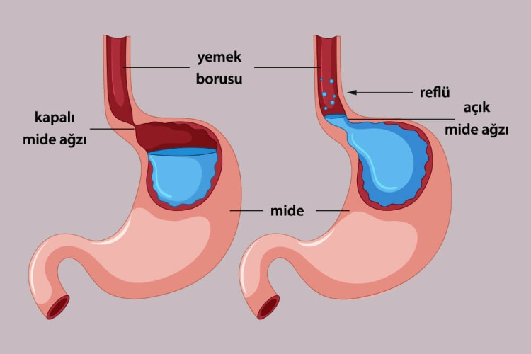 Lifli besinler sindirimi destekler