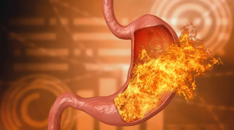 Kafein ve çikolata tüketimine dikkat