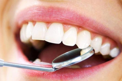 Ağız sağlığını ihmal edenler dikkat: Sessiz başlayan hastalıklar kalp ve diyabete kadar ilerleyebilir!