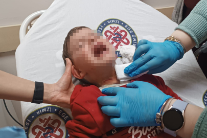 Parkta oynayan 2 yaşındaki çocuğa bıçaklı saldırı