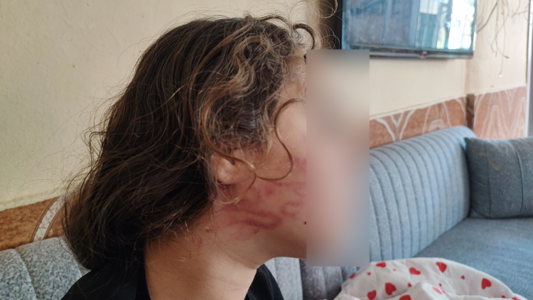Adana'da çocuk kavgasına anne müdahalesi 11 yaşındaki epilepsi hastası çocuk hastanelik oldu 2