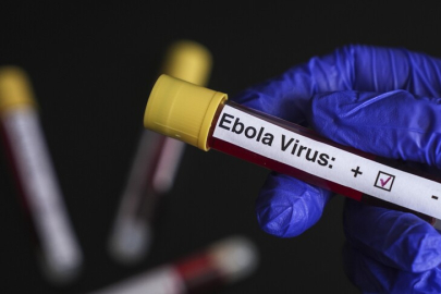 DSÖ alarm verdi: KDC'de 900’den fazla şüpheli ebola vakası