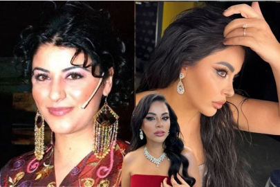 20 kilo veren şarkıcı Zara eski haliyle gündem oldu