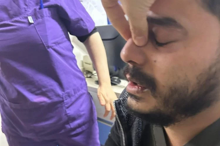Gaziantep’te darp edilen doktorun burnu kırıldı